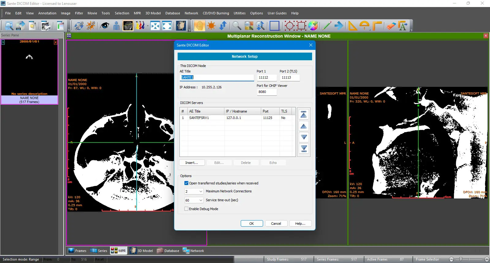 Пользовательсткй интерфейс Sante DICOM Editor 10.0.6 [En]