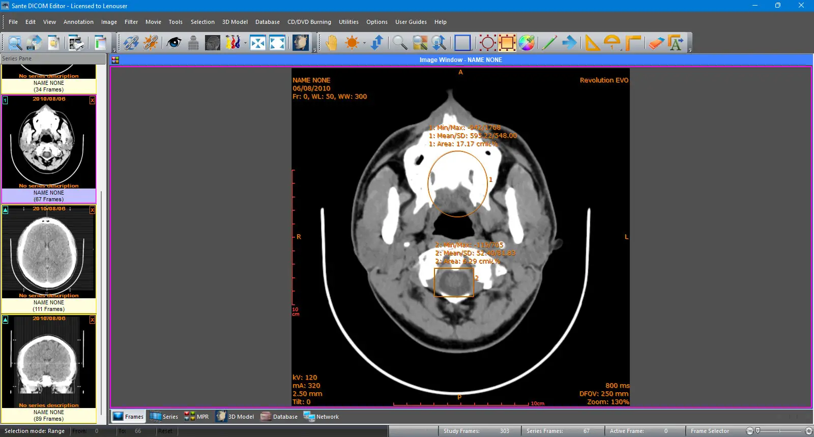 Пользовательсткй интерфейс Sante DICOM Editor 8.2.7 [En]