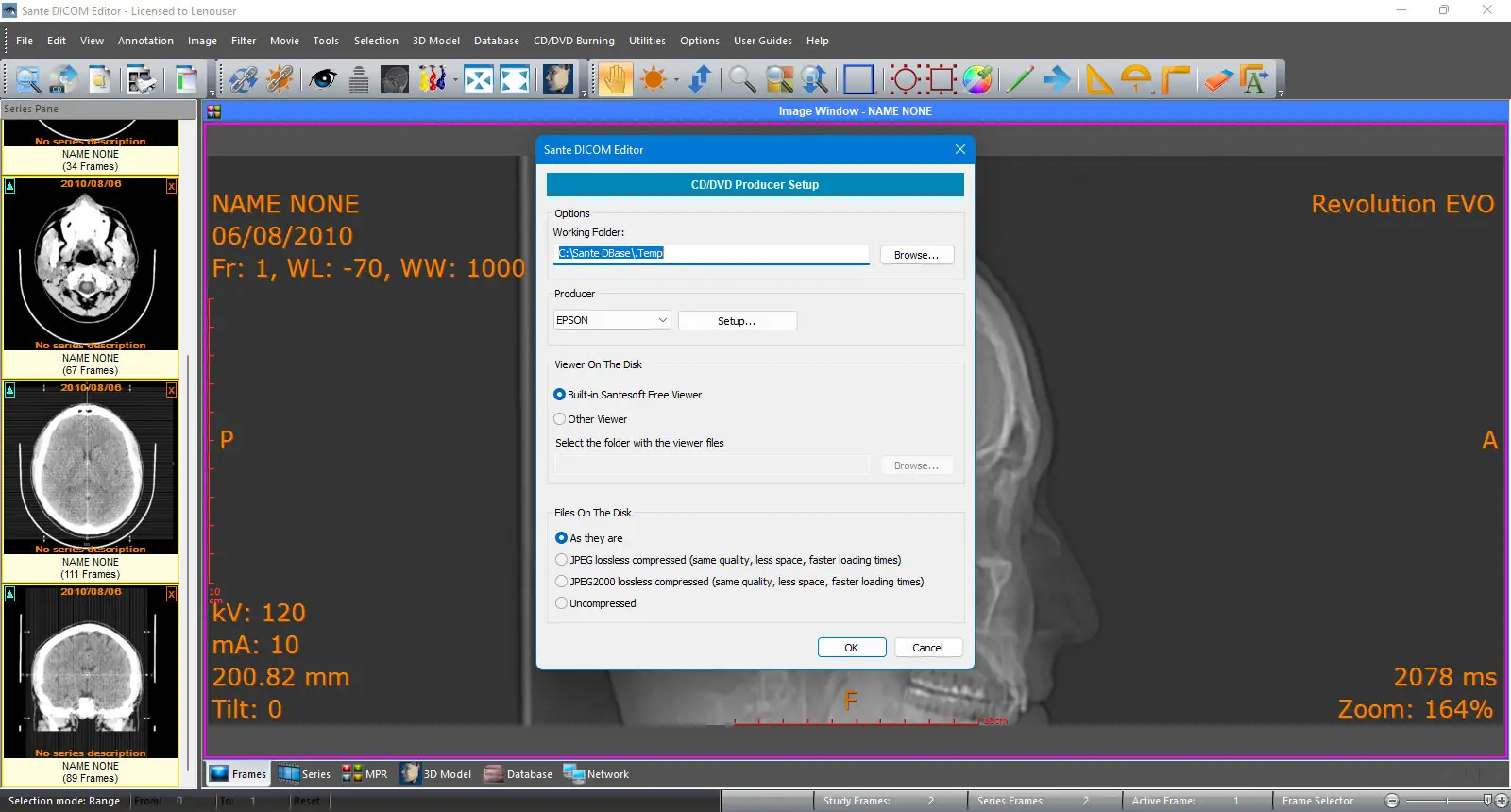 Пользовательсткй интерфейс Sante DICOM Editor 8.2.8 [En]