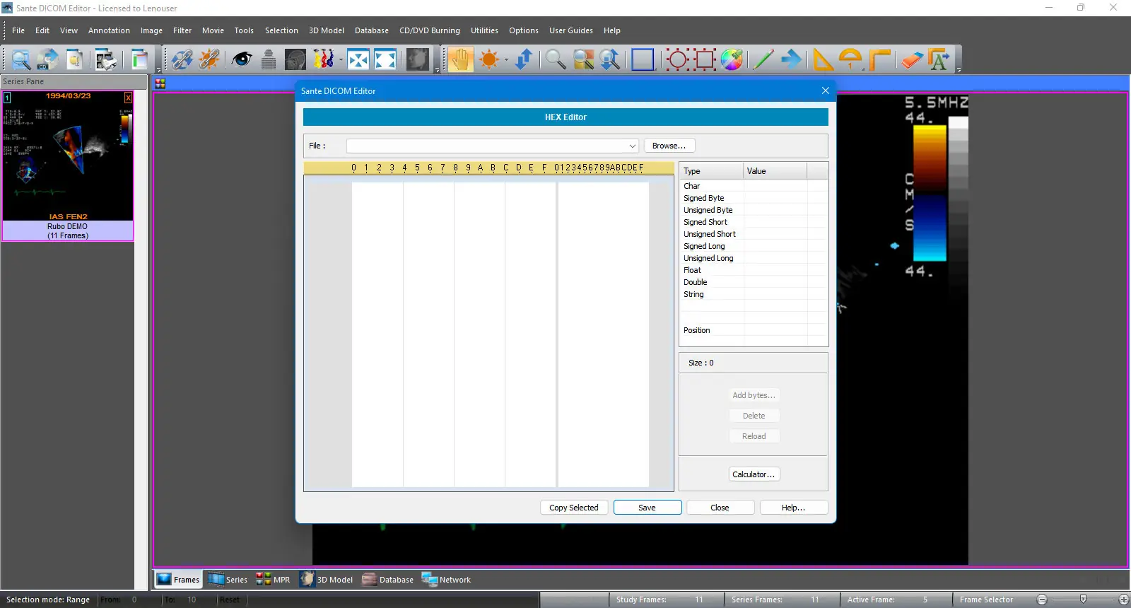 Пользовательсткй интерфейс Sante DICOM Editor 8.2.9 [En]