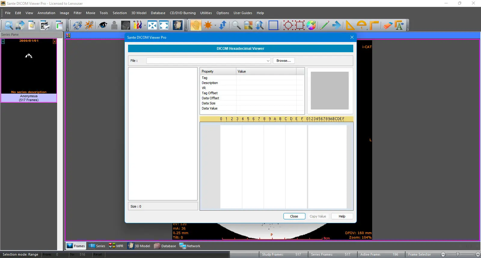 Пользовательсткй интерфейс Sante DICOM Viewer Pro 12.2.9 [En]
