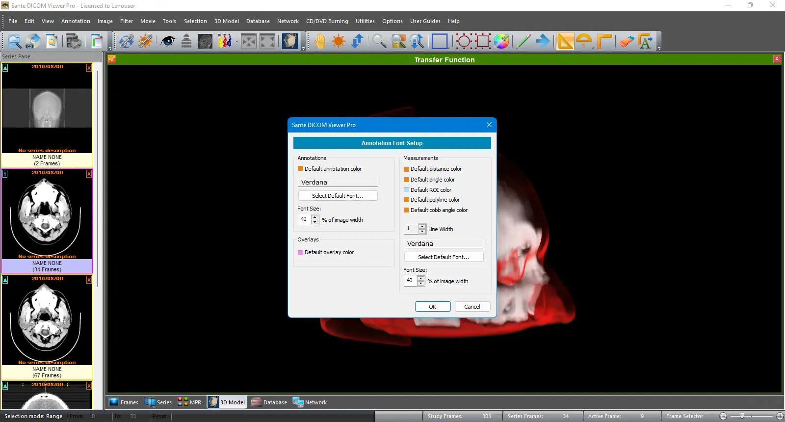 Пользовательсткй интерфейс Sante DICOM Viewer Pro 14.0.7 [En]